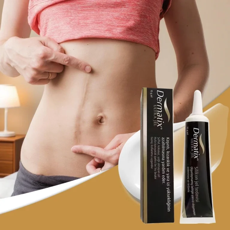 Buy Dermatix Ultra Silicone Scar Treatment Gel Advanced Healing 15g for sale